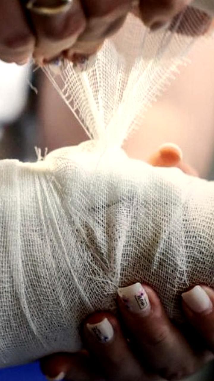 Российские учёные разработали наночастицы для ускорения заживления кожи