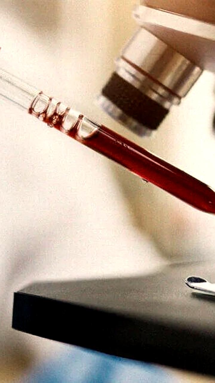 Рост заболеваемости ВИЧ в России: Иркутская область, Республика Хакасия и Республика Коми на переднем плане