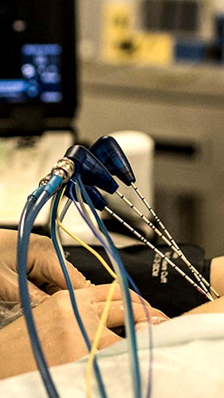 В России создан прототип устройства для лечения рака микроволновым излучением