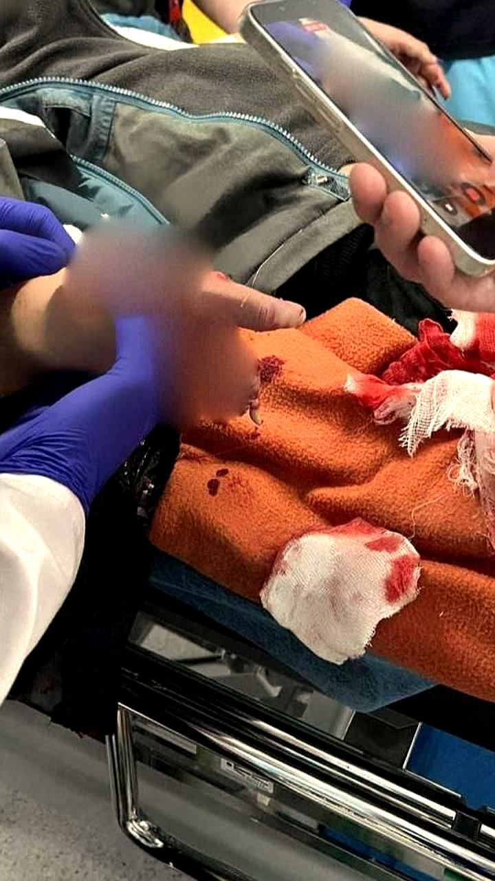 В Красногорске 9-летний мальчик пострадал от взрывного устройства на детской площадке