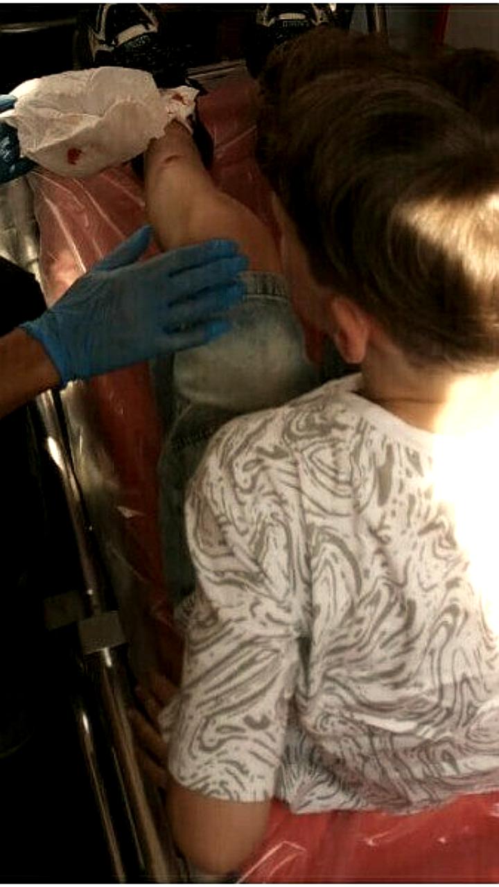 Суд взыскал 80 тыс. рублей с МБУ ГСТК за травму ребенка на детской площадке в Благовещенске