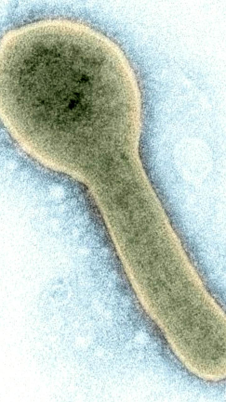 В России обнаружены более 60 неизвестных вирусов, сообщает гендиректор Вектора