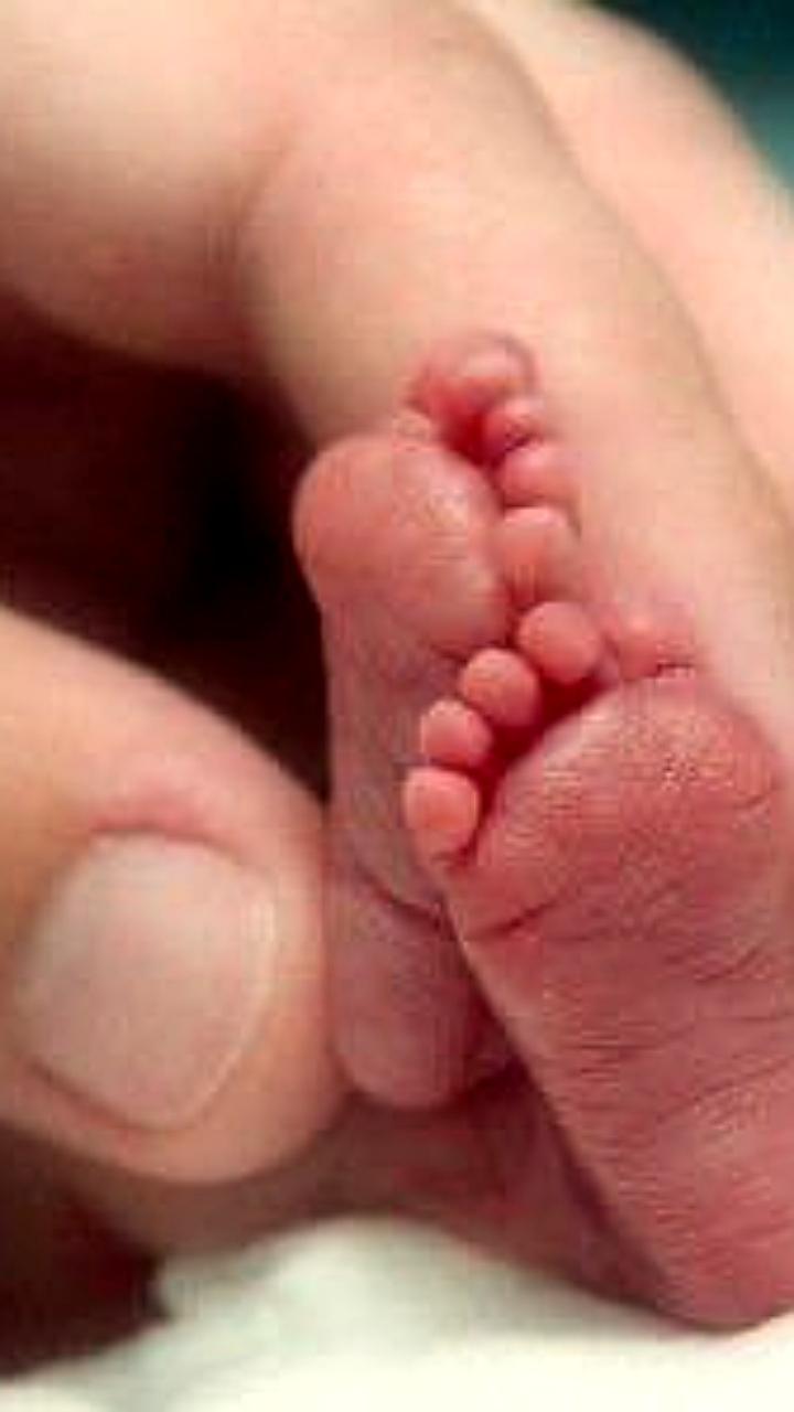 Орские и мурманские перинатальные центры отмечают Международный день недоношенных детей