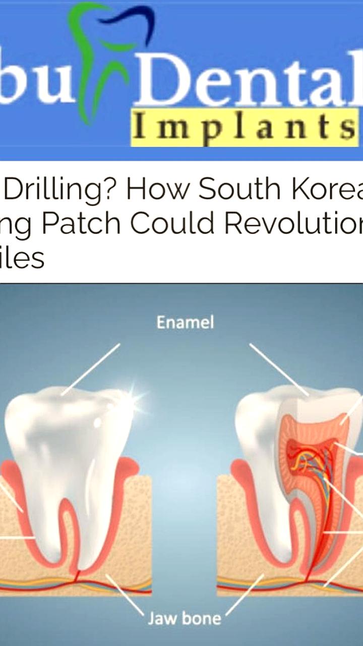 В Корее разработан биорастворимый пластырь для регенерации зубов