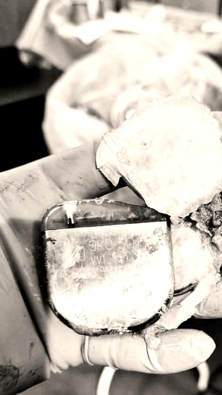 Уникальная операция по закрытию дефекта сердца проведена полуторагодовалому ребенку в Благовещенске