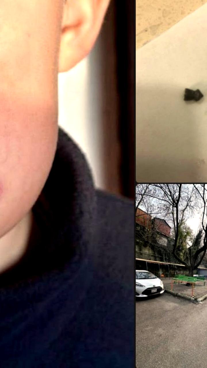 В Туапсе неизвестный выстрелил в девятилетнего мальчика, полиция проводит расследование