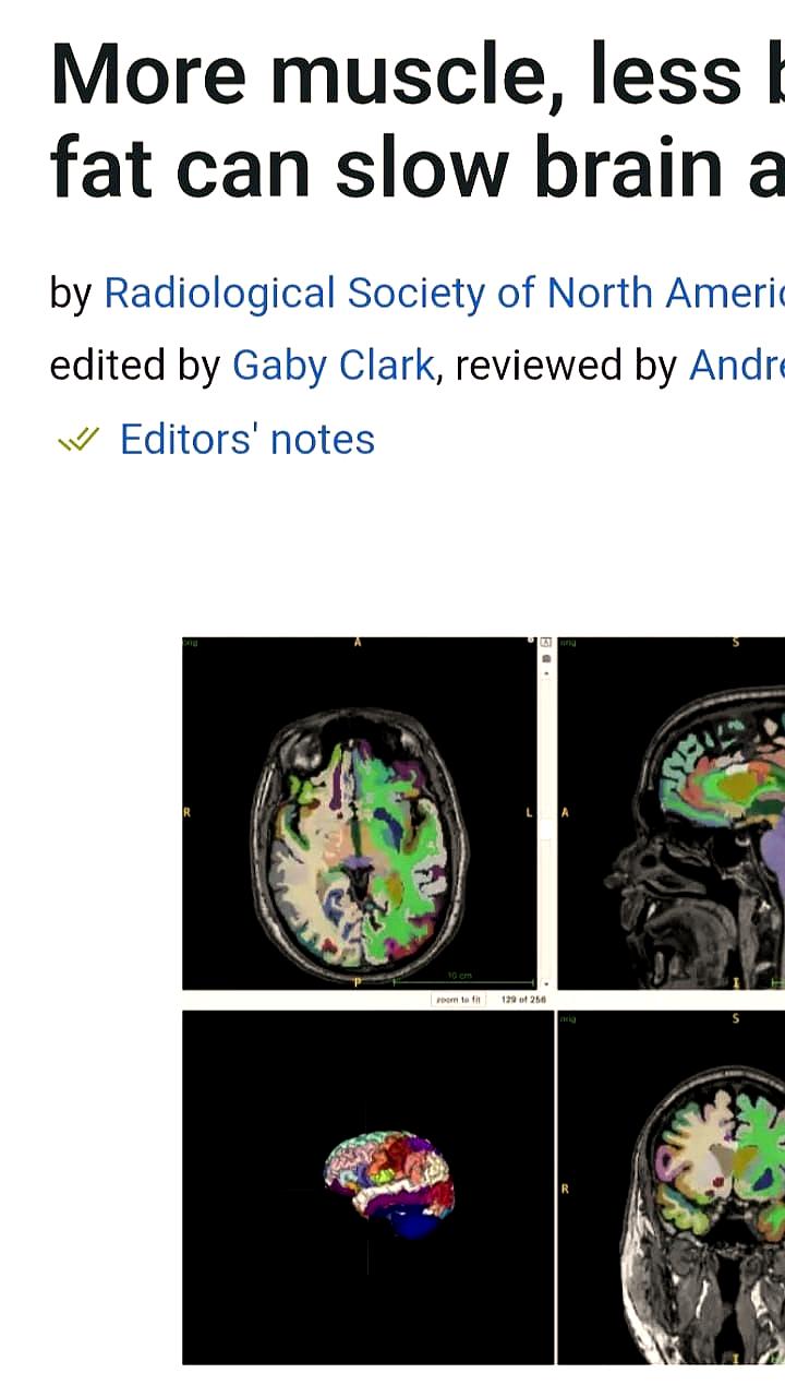 Исследования подтверждают связь между мышечной массой и замедлением старения мозга