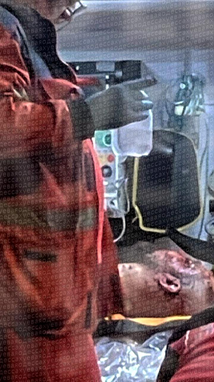 Взрыв гранат в Одессе: мужчина тяжело ранен после инцидента в жилом доме