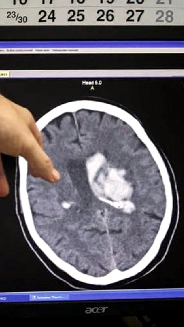 Российские ученые применили новый подход для поиска противораковых соединений