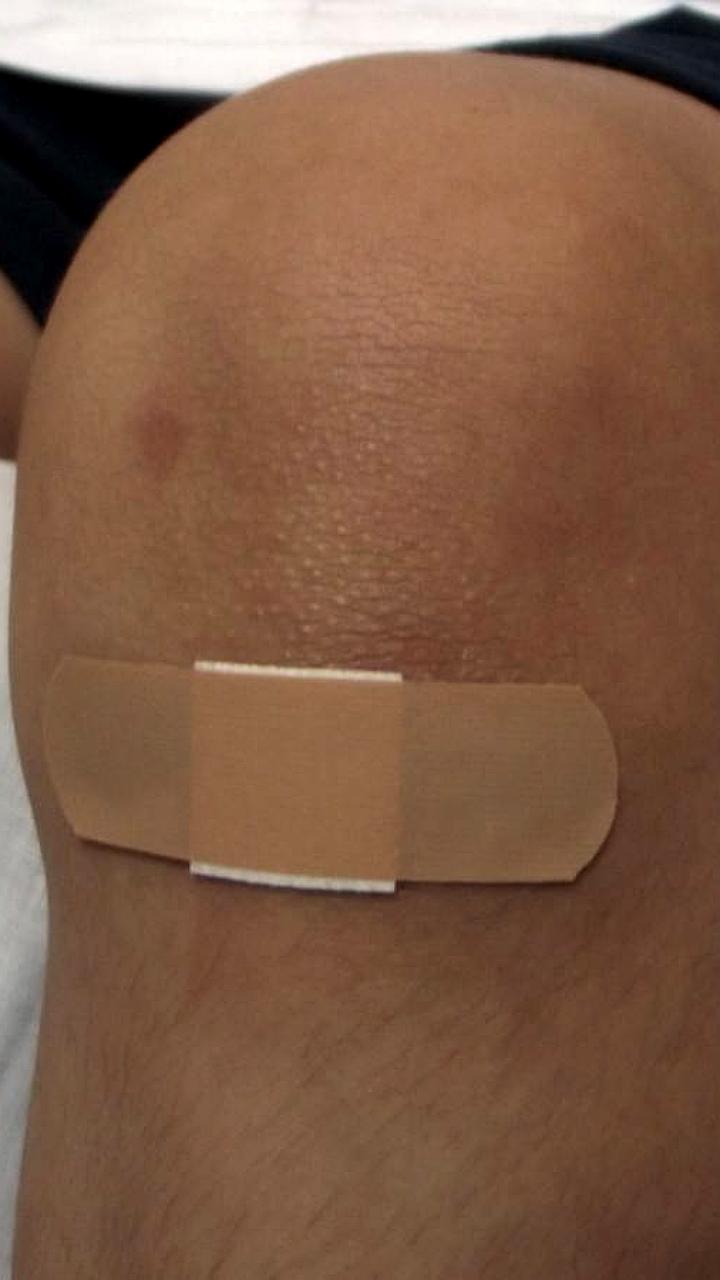 Врачи ЧОКБ успешно провели операцию по спасению ноги 21-летнего строителя