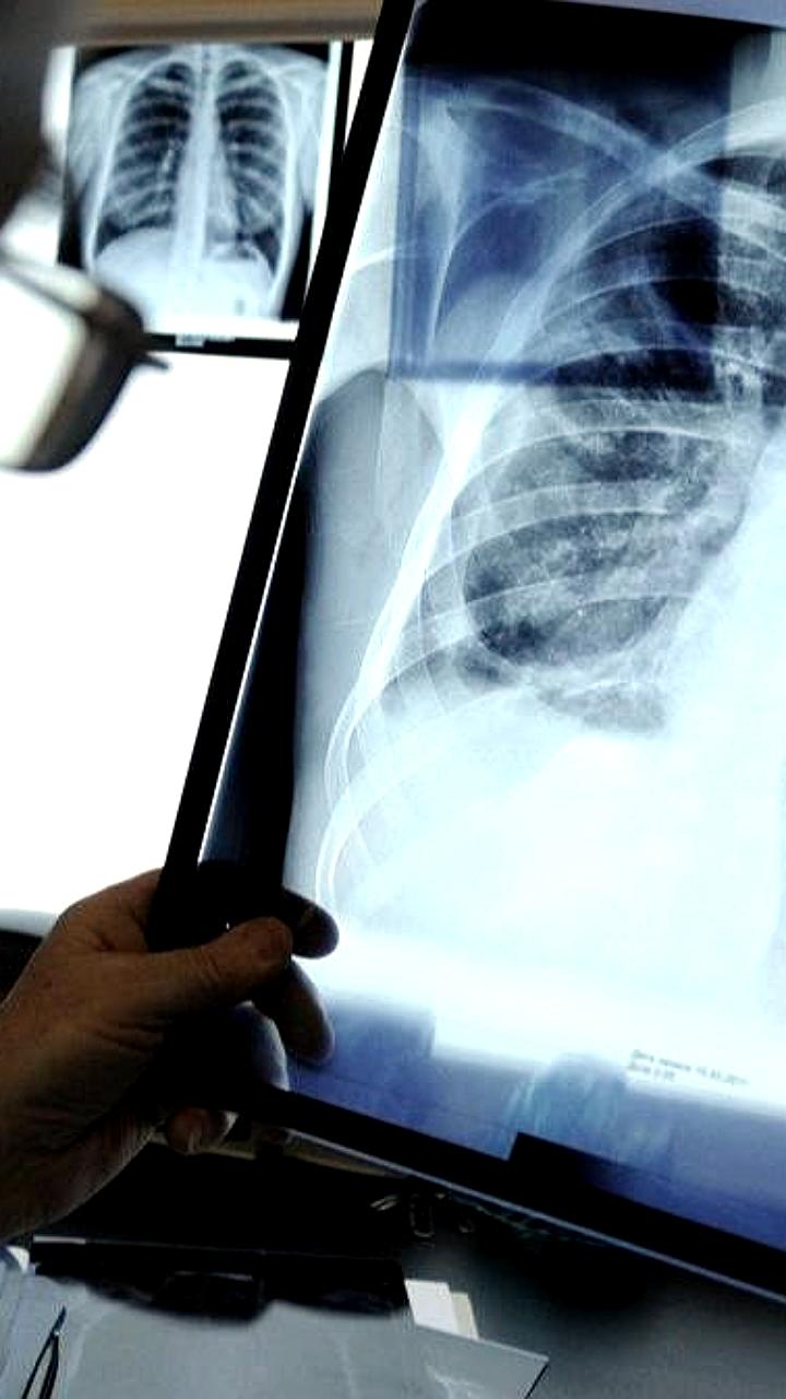 Проверка прокуратуры после случаев туберкулеза в школе Спасского района