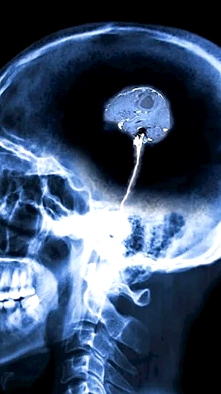 Исследование из Осло: Мужчины стареют быстрее женщин по данным МРТ