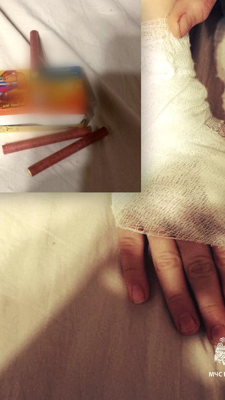 В Удмуртии 10-летний мальчик получил ожоги от петарды