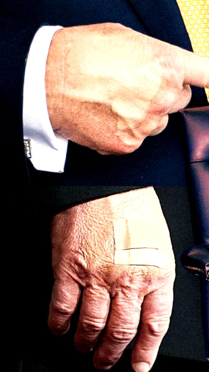 Дональд Трамп обсуждает свое здоровье и медицинские рекомендации в интервью