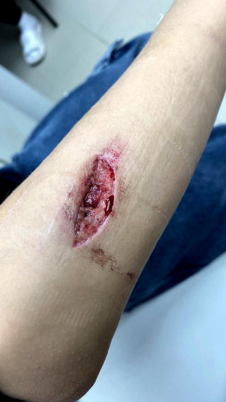 Проверка качества медицинской помощи ребенку в Фокино после инцидента