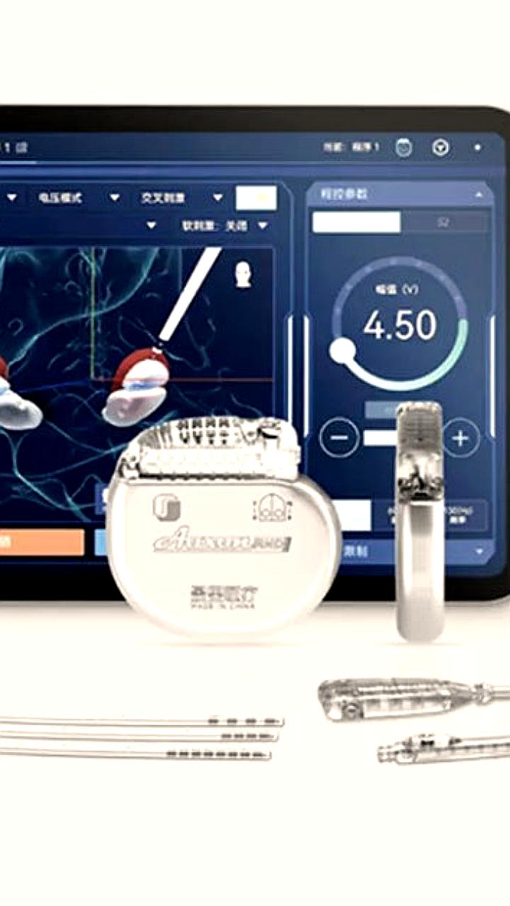 Клиническое испытание нейроимплантов в Китае привело к зависимостям у пациентов