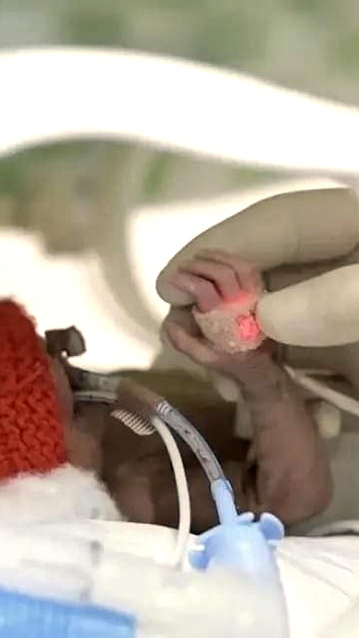 В Башкирии успешно выхаживают новорожденную девочку весом 480 граммов