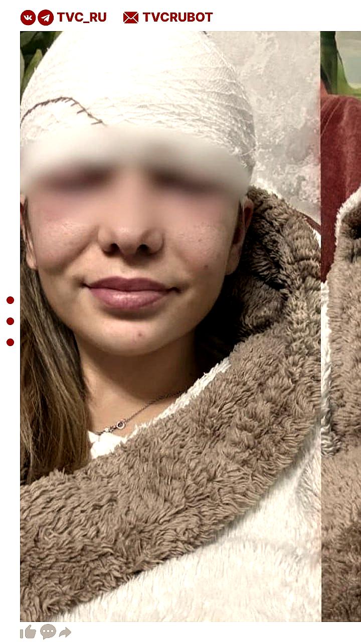 Жительница Архангельской области госпитализирована из-за осложнений после выдавливания прыща