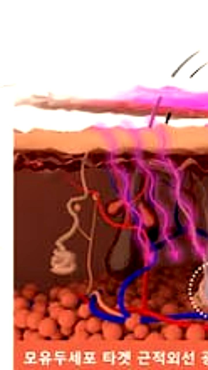 Корейские ученые разработали OLED шляпу для борьбы с облысением