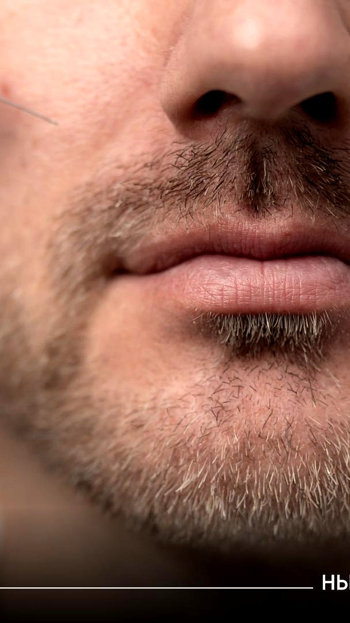 Рост интереса мужчин к пластической хирургии в России: увеличение пениса и похудение