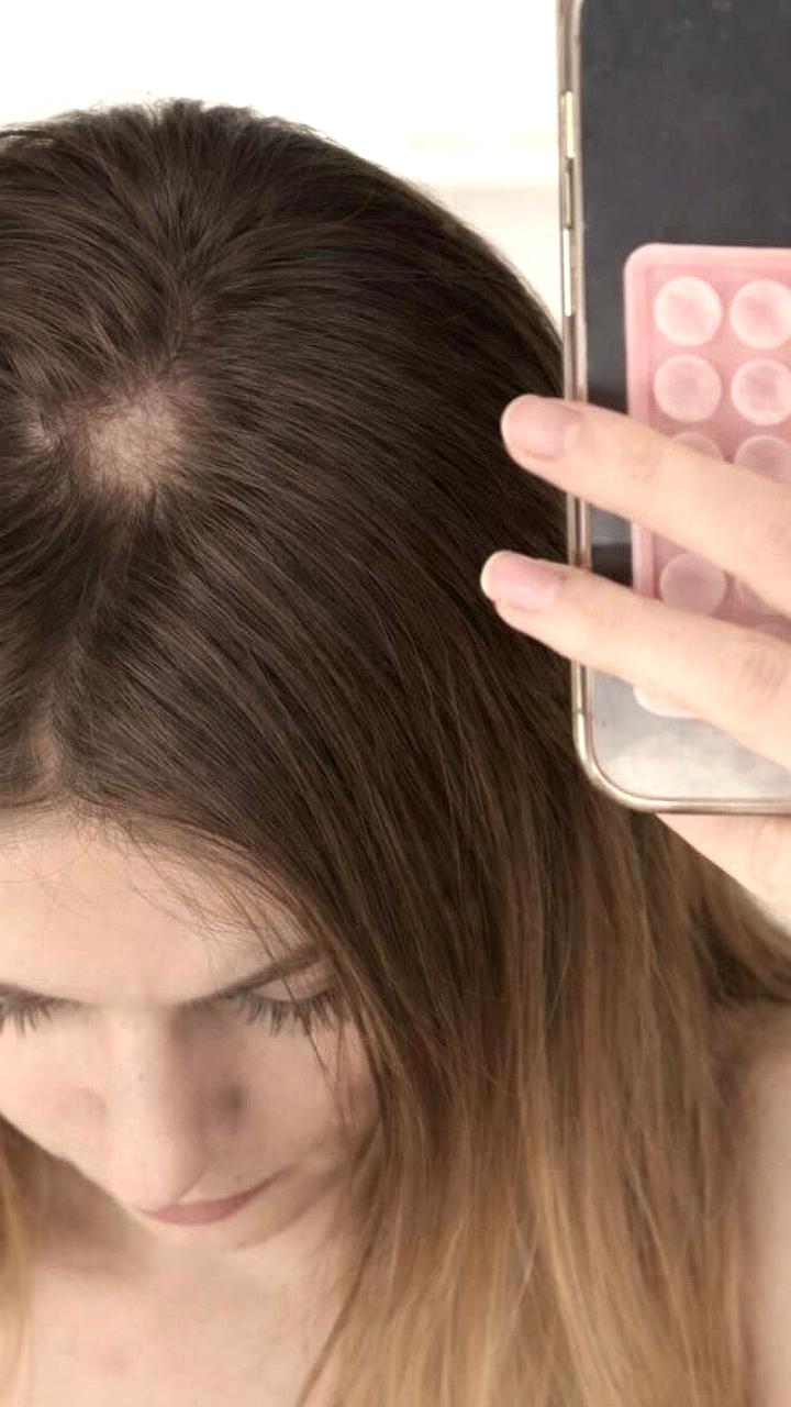 Москвичка столкнулась с выпадением волос после примерки шапки с маркетплейса