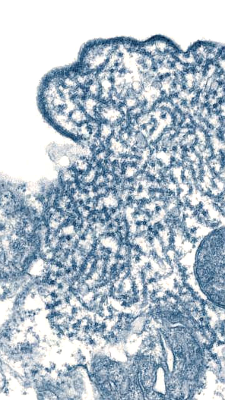 Вирус Нипах: первая смерть в Бангладеш и низкий риск глобального распространения, по данным ВОЗ