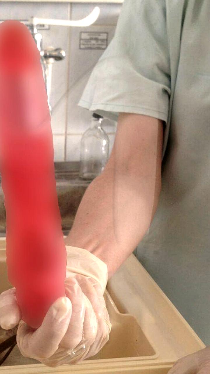 Необычный инцидент в Уфе: мужчина госпитализирован после встречи с силиконовой игрушкой