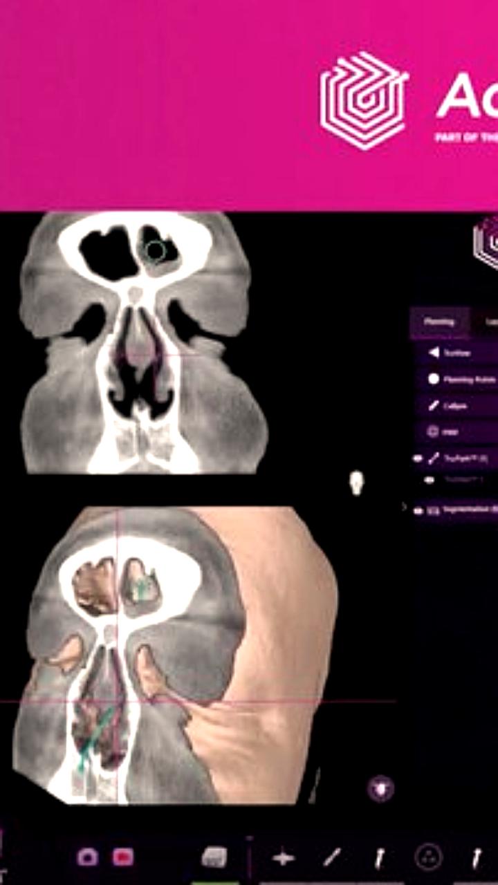 Проблемы с медицинскими устройствами на основе ИИ: отчеты FDA фиксируют инциденты