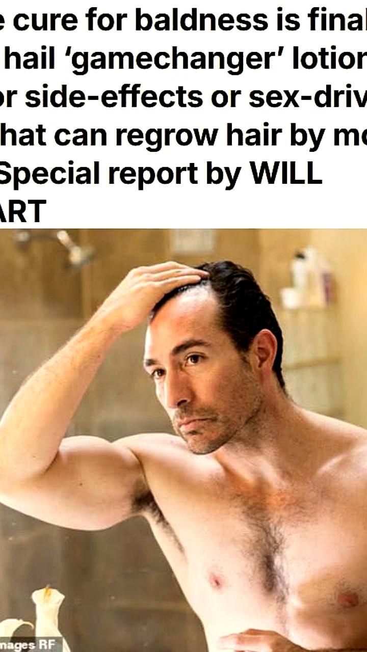 Класкотерон: новый лосьон для роста волос показал пятилетнее улучшение