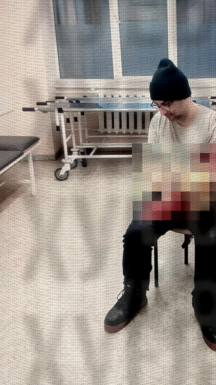 Одессит госпитализирован после неудачной попытки избежать мобилизации