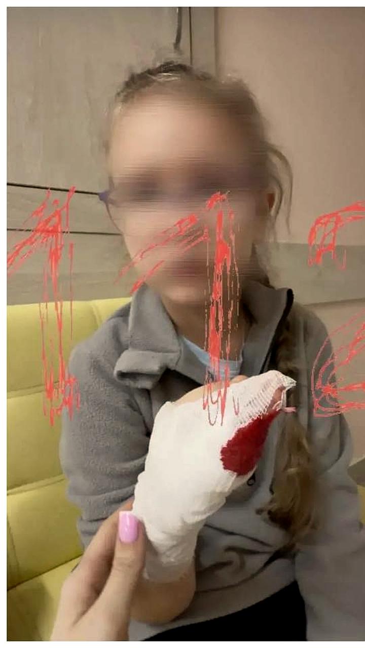 Врачи Ингушетии успешно провели операцию на руке полуторагодовалого ребёнка