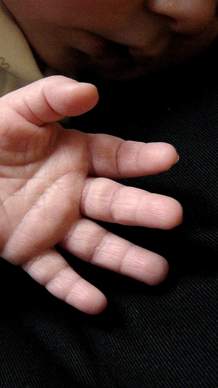 Семимесячный мальчик получил ожоги в Хабаровске из-за горячей воды