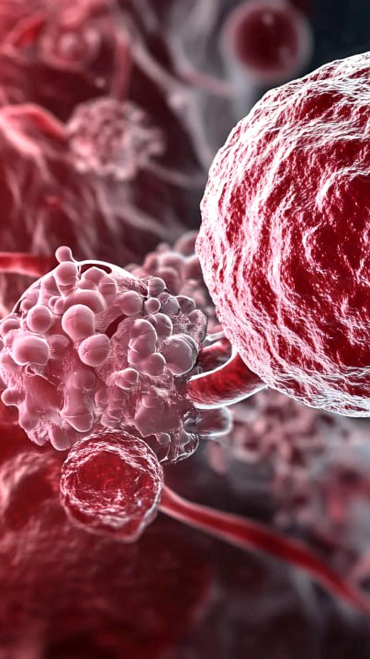 Россия первой в мире начала применять вакцину против меланомы с высокой эффективностью