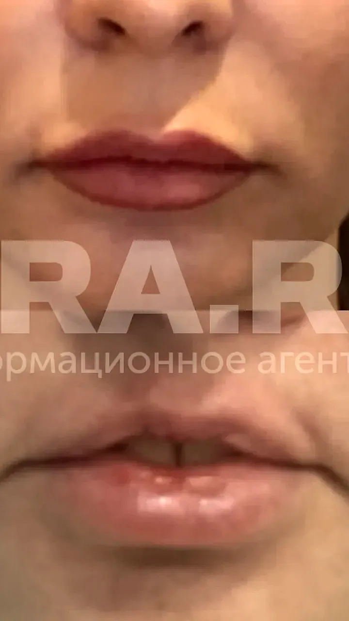 Жительница Губкинского выиграла суд против стоматологии на сумму свыше миллиона рублей