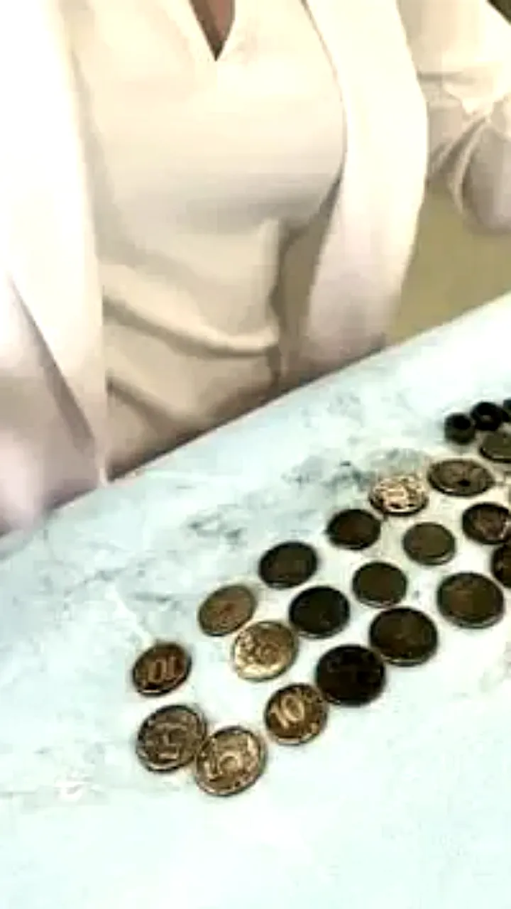 Волгоградские врачи успешно извлекли 214 монет и металлические предметы из желудка пациента
